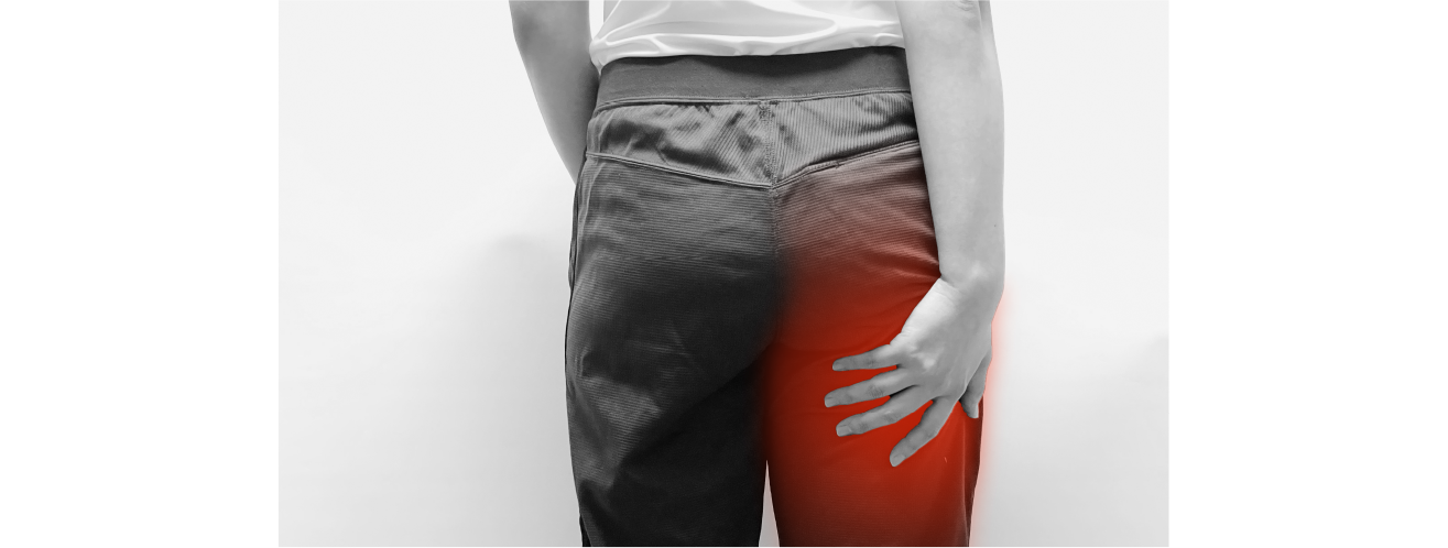 坐骨神経痛イメージ